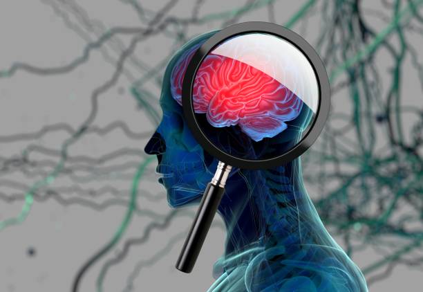You are currently viewing Penumpukan Cairan Di Otak: Bahaya dan Penanganannya